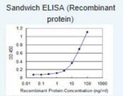 UNC13D/Munc 13-4 Antibody (2C7), Novus Biologicals 0.1 mg | Buy Online | Novus Biologicals | Fisher Scientific