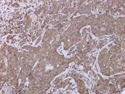 UPF3B Antibody, Novus Biologicals 100 &mu;g | Buy Online | Novus Biologicals | Fisher Scientific