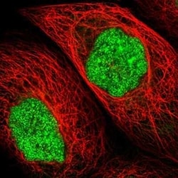 UPP2 Antibody, Novus Biologicals 0.1 mL; Unconjugated:Antibodies, Polyclonal