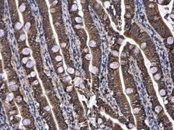 UQCRB Antibody, Novus Biologicals 100 &mu;g | Buy Online | Novus Biologicals | Fisher Scientific