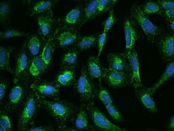 UQCRC2 Antibody, Novus Biologicals 100 &mu;g, Unconjugated:Antibodies,