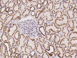 UQCRC2 Antibody, Novus Biologicals 100 &mu;g, Unconjugated:Antibodies,