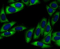 UQCRFS1 Antibody (JG62-31), Novus Biologicals 100 &mu;l; Unconjugated:Antibodies,