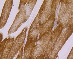 UQCRFS1 Antibody (JG62-31), Novus Biologicals 100 &mu;l; Unconjugated:Antibodies,