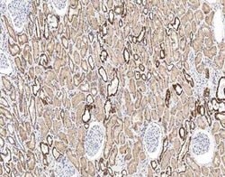 UQCRH Antibody, Novus Biologicals 100 &mu;g; Unconjugated:Antibodies, Polyclonal