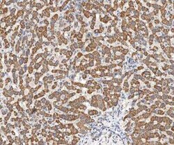 UQCRH Antibody, Novus Biologicals 100 &mu;g; Unconjugated:Antibodies, Polyclonal