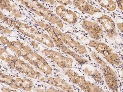 UROS Antibody, Novus Biologicals 50 &mu;g, Unconjugated:Antibodies, Polyclonal