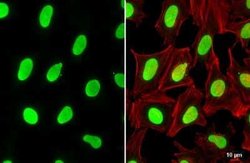 USF2 Antibody, Novus Biologicals 100 &mu;g | Buy Online | Novus Biologicals | Fisher Scientific