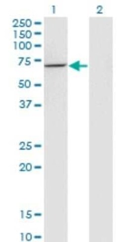 USH1C Antibody (2B3), Novus Biologicals 0.1 mg | Buy Online | Novus Biologicals | Fisher Scientific