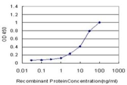 USH1C Antibody (2B9), Novus Biologicals 0.1 mg | Buy Online | Novus Biologicals | Fisher Scientific