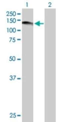 USP1 Antibody, Novus Biologicals 0.05 mg | Buy Online | Novus Biologicals | Fisher Scientific