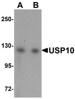 USP10 Antibody - BSA Free, Novus Biologicals 0.025 mg; Unconjugated:Antibodies,