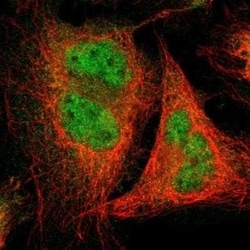 USP13 Antibody, Novus Biologicals 25 &mu;L | Buy Online | Novus Biologicals | Fisher Scientific