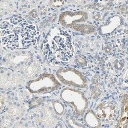 USP13 Antibody, Novus Biologicals 25 &mu;L | Buy Online | Novus Biologicals | Fisher Scientific
