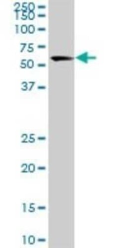 USP14 Antibody (1F8), Novus Biologicals 0.1 mg | Buy Online | Novus Biologicals | Fisher Scientific