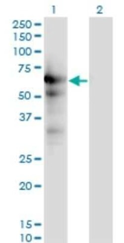 USP14 Antibody (6D6), Novus Biologicals 0.1 mg | Buy Online | Novus Biologicals | Fisher Scientific