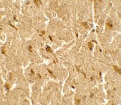 USP25 Antibody - BSA Free, Novus Biologicals 0.1 mg | Buy Online | Novus Biologicals | Fisher Scientific