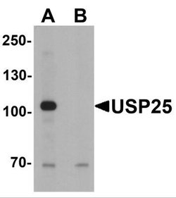 USP25 Antibody - BSA Free, Novus Biologicals 0.1 mg | Buy Online | Novus Biologicals | Fisher Scientific