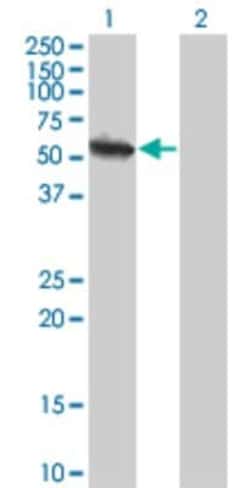 Novus Biologicals USP3 Antibody (1H2), Novus Biologicals 0.1 mg | Buy Online | Novus Biologicals&trade; | Fisher Scientific
