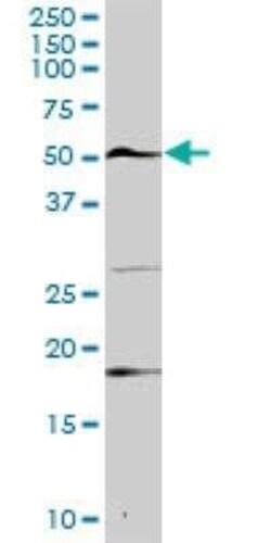 USP3 Antibody, Novus Biologicals 0.1 mg | Buy Online | Novus Biologicals | Fisher Scientific