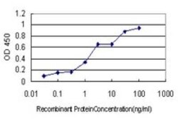USP33 Antibody (5B5), Novus Biologicals 0.1 mg | Buy Online | Novus Biologicals | Fisher Scientific