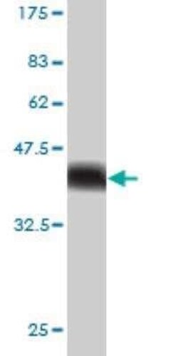 USP34 Antibody (2E2), Novus Biologicals 0.1 mg | Buy Online | Novus Biologicals | Fisher Scientific