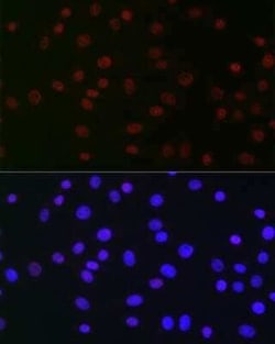 USP39 Rabbit anti-Human, Mouse, Rat, Clone: 1S9R9, Novus Biologicals 100