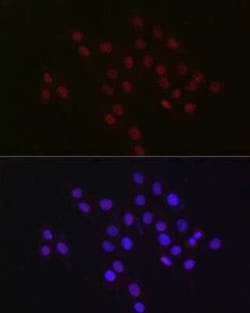 USP39 Rabbit anti-Human, Mouse, Rat, Clone: 1S9R9, Novus Biologicals 100