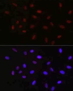 USP39 Rabbit anti-Human, Mouse, Rat, Clone: 1S9R9, Novus Biologicals 100