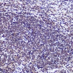 USP39 Rabbit anti-Human, Mouse, Rat, Clone: 1S9R9, Novus Biologicals 100