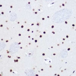 USP39 Rabbit anti-Human, Mouse, Rat, Clone: 1S9R9, Novus Biologicals 100