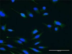 USP47 Antibody (1E6), Novus Biologicals 0.1 mg | Buy Online | Novus Biologicals | Fisher Scientific