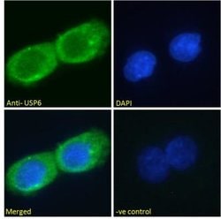 USP6 Antibody, Novus Biologicals 0.1 mg; Unconjugated:Antibodies, Polyclonal