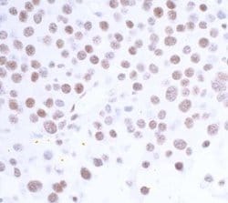 USP7 Antibody (BLR072G), Novus Biologicals 100 &mu;L; Unconjugated:Antibodies,