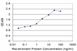 UT2/SLC14A2 Antibody (3E7), Novus Biologicals 0.1 mg | Buy Online | Novus Biologicals | Fisher Scientific