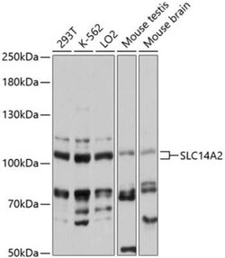 UT2/SLC14A2 Antibody - Azide and BSA Free, Novus Biologicals 0.02 mL; Unconjugated:Antibodies,