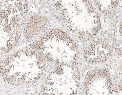 UTF1 Antibody, Novus Biologicals:Antibodies:Primary Antibodies