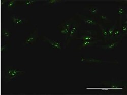 UTP18 Antibody, Novus Biologicals 50 &mu;g | Buy Online | Novus Biologicals | Fisher Scientific