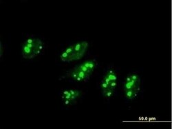 UTP3 Antibody, Novus Biologicals 0.05 mg | Buy Online | Novus Biologicals | Fisher Scientific