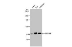 UVRAG Antibody, Novus Biologicals 100 &mu;g | Buy Online | Novus Biologicals | Fisher Scientific