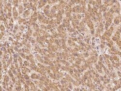 UVSSA Antibody, Novus Biologicals:Antibodies:Primary Antibodies