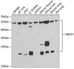 UbcH2/UBE2H Antibody - BSA Free, Novus Biologicals 0.02 mL, Unconjugated:Antibodies,