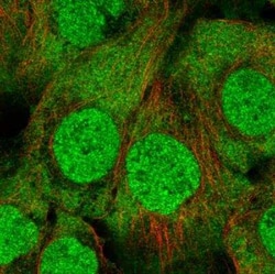 UbcH7/UBE2L3 Antibody, Novus Biologicals:Antibodies:Primary Antibodies
