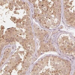 UbcH7/UBE2L3 Antibody, Novus Biologicals:Antibodies:Primary Antibodies
