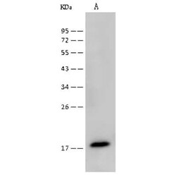 UbcH7/UBE2L3 Antibody, Novus Biologicals:Antibodies:Primary Antibodies