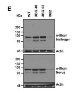 Ubiquilin 2 Antibody (5F5), Novus Biologicals 0.1 mg | Buy Online | Novus Biologicals | Fisher Scientific