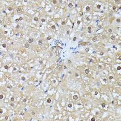 Ubiquitin C Antibody - BSA Free, Novus Biologicals 0.02 mL; Unconjugated:Antibodies,