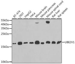 Uev1a/UBE2V1 Antibody - BSA Free, Novus Biologicals 100 &mu;g; Unconjugated:Antibodies,