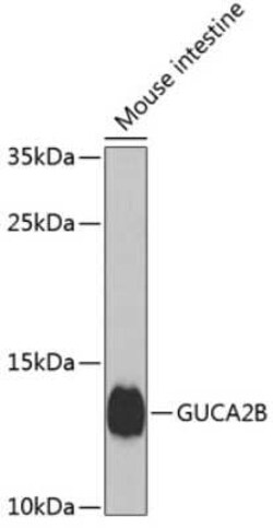 Uroguanylin Antibody - BSA Free, Novus Biologicals 0.1 mL; Unconjugated:Antibodies,