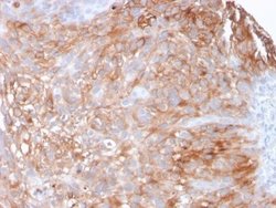 Uroplakin Ia Antibody (UPK1A/2925) - Azide and BSA Free, Novus Biologicals